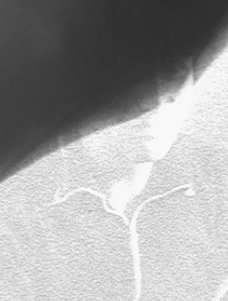 Лекция. Графическая партитура: о ключах к свободе