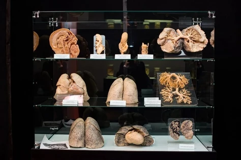 Программа "Анатомический Эрмитаж" в Первом медицинском Университете 12+